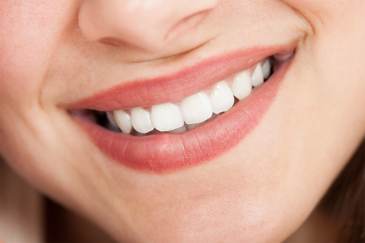 Teeth Whitening Solution in Livermore California Area