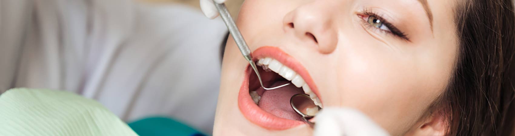 Overcome Your Cavities with Tooth-colored Composite Fillings