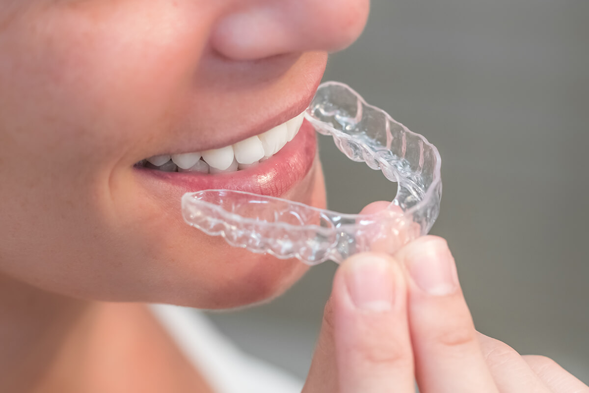 Invisible Braces For Teens in Livermore CA Area